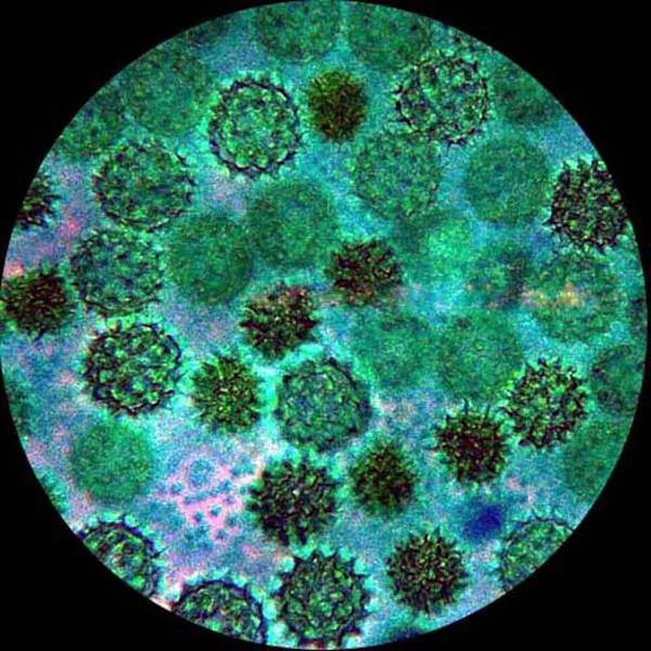 AmScope T590 Series Biological Trinocular Compound Microscope