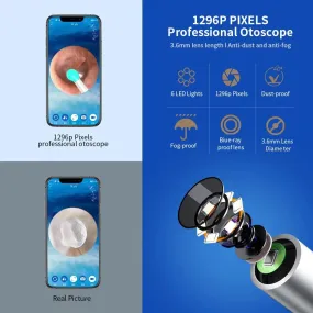 Wireless Otoscope Kit: Advanced Ear Cleaning Tech & Smart Connectivity
